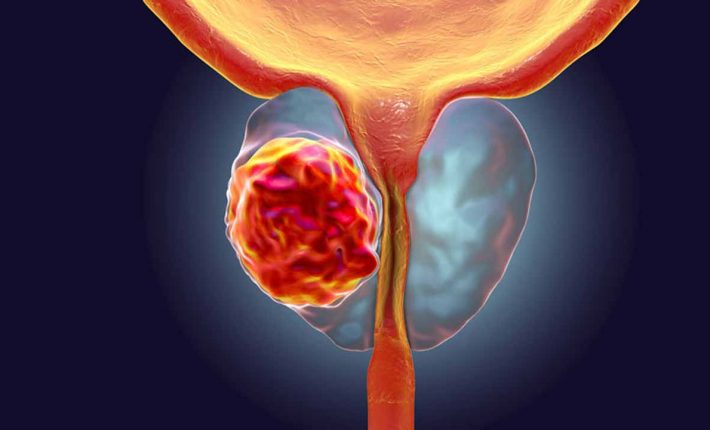 Prostaline capsule prostata – pareri, pret, forum, prospect, farmacii